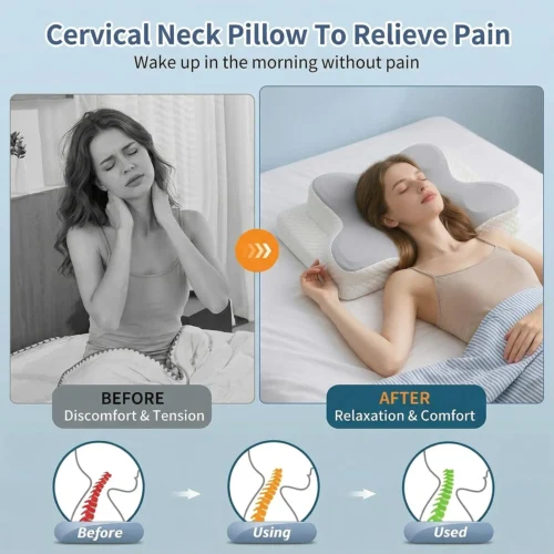 Alternative view of YHUKB Cervical Neck Pillow for Pain Relief Sleeping, Memory Foam Body Positioner, White, Standard Size, Ergonomic Design with Removable Cover for Back and Side Sleepers